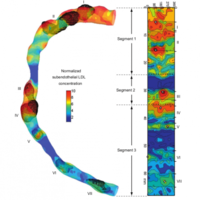 Computed high concentrations of low-density lipoprotein correlate with plaque locations in human coronary arteries