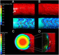 Compound ex vivo and in silico method for hemodynamic analysis of stented arteries