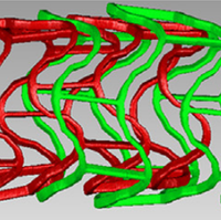 Hemodynamics in coronary arteries with overlapping stents