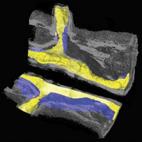 Complementary X-ray tomography techniques for histology-validated 3D imaging of soft and hard tissues using plaque-containing blood vessels as examples