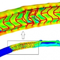 Drug deposition in coronary arteries with overlapping drug-eluting stents