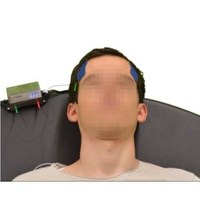 Noninvasive monitoring of intracranial pulse waves