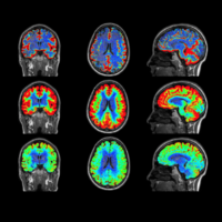Current understanding of the anatomy, physiology, and magnetic resonance imaging of neurofluids: Update from the 2022 ISMRM imaging neurofluids study group workshop in Rome