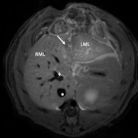 Assessment of liver function by gadoxetic acid avidity in MRI in a model of rapid liver regeneration in rats