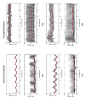 Cerebrospinal fluid pressure dynamics across the intra- and postoperative setting: Retrospective study of a spine surgery cohort