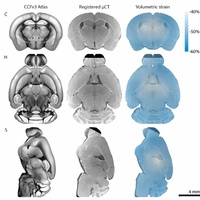 Synchrotron radiation-based tomography of an entire mouse brain with sub-micron voxels: augmenting interactive brain atlases with terabyte data